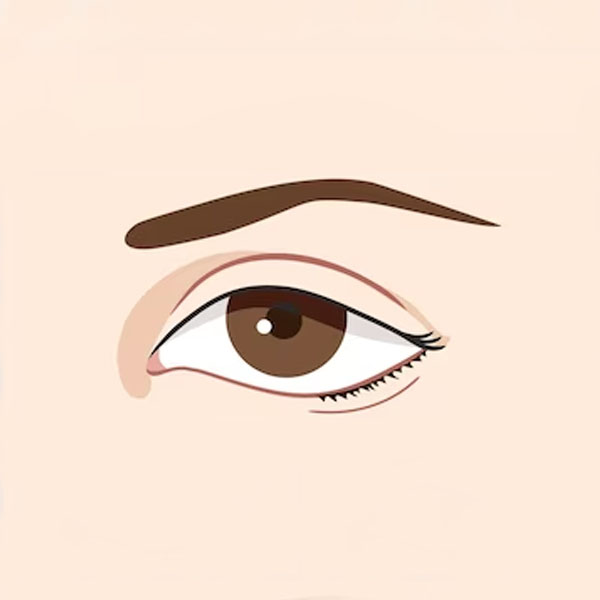 eyelid reduction